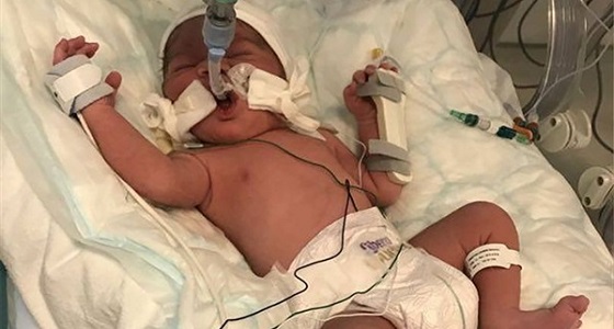 بالصور.. جنين ينجو من الموت بعد مقتل أمه بالرصاص في بطنها