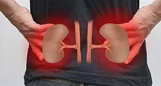 لمرضى الكلى.. 3 نصائح تجنبك نوبات المغص الكلوي