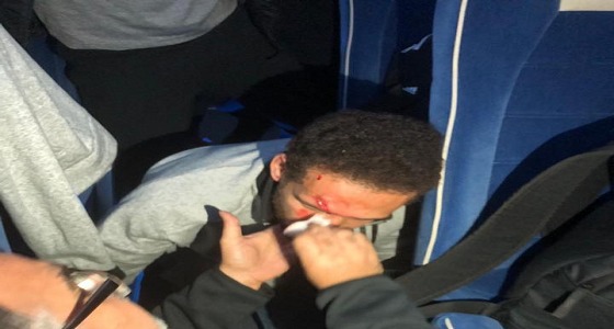 الاعتداء على حافلة الأهلي المصري بتونس.. وإصابة لاعب