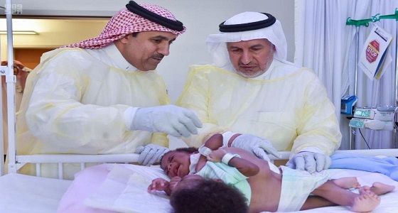 إجراء عملية فصل التوأم السيامي التنزاني ” أنيشيا و ملينيز ” الأحد القادم
