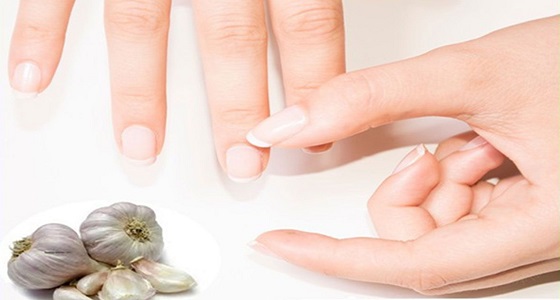 علاقة الثوم بتقوية ولمعان الأظافر