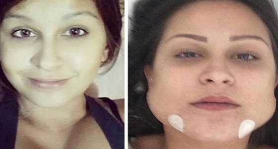 بالصور.. طبيب يشوه وجه 40 شخص بعمليات التجميل