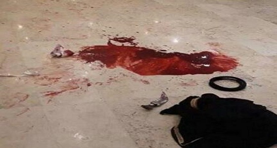 آخر التطورات الصحية للعريس المطعون في عرسه