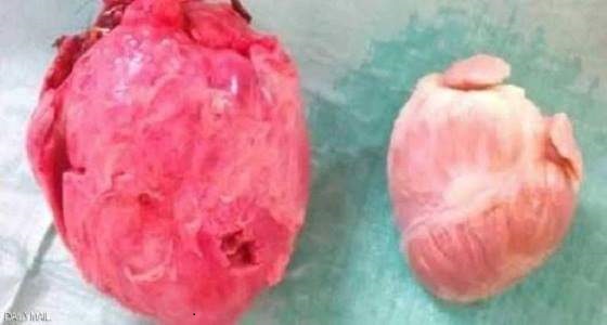 ثورة طبية باتت على بعد خطوة.. نقل أعضاء الحيوانات إلى البشر