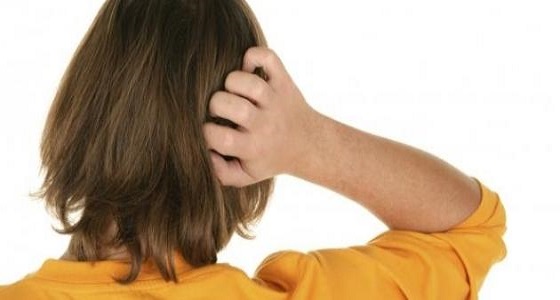 الموز يخلصك من ” حكة الرأس “