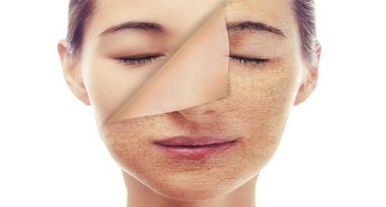 فيتامينات تحافظ على وجهك من التقشر