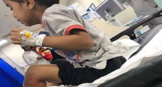 آخر المستجدات بقضية الطفل الملسوع من كائن بحري غريب في جازان