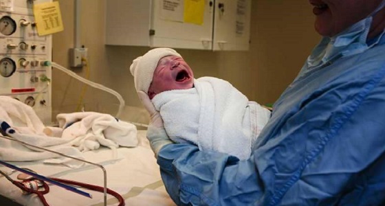 للمرة الأولى.. ولادة طفلة من رحم امرأة متوفية