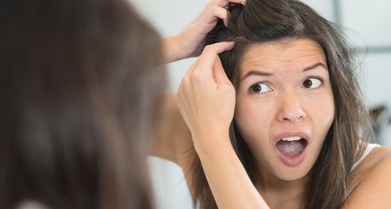 3 وصفات للتخلص من قشرة الشعر