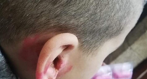 أب يسمح لزوجته بتعنيف ابنته وشقيقها دون سبب