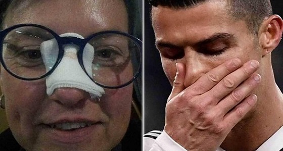 بالصور.. بعد تسببه في إصابتها.. ” رونالدو ” يجبر بخاطر مشجعة يوفنتوس