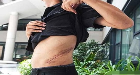 بالصور .. مصير شاب باع كليته منذ 8 سنوات لشراء ” آيفون “