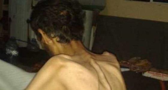 صورة مروعة من داخل سجون الحوثيين