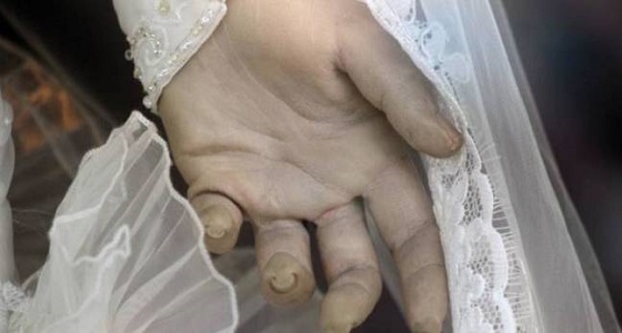 بعد يومين من زفافها.. صعق كهربائي ينهي حياة عروس