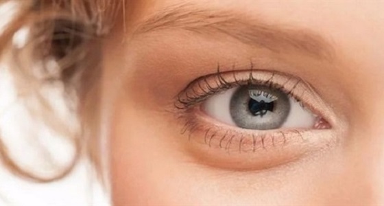 بالفيديو.. وصفة طبيعية تخلصك من انتفاخات العين