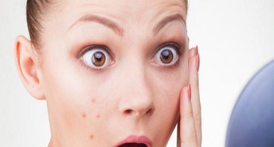 تخلصي من أثار الحبوب عقب ” الدورة الشهرية ” بمكونين فقط