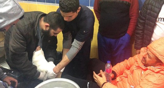 بالصور.. محمد حماقي يتعرض لإصابة بالغة