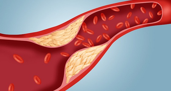 نصيحة طبية: تجنب مخاطر ” الكوليسترول ” بالخضراوات والفواكه