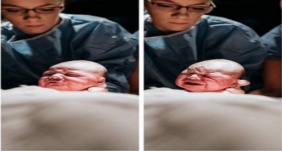 أم تلتقط صورا لنفسها أثناء خضوعها لعملية الولادة