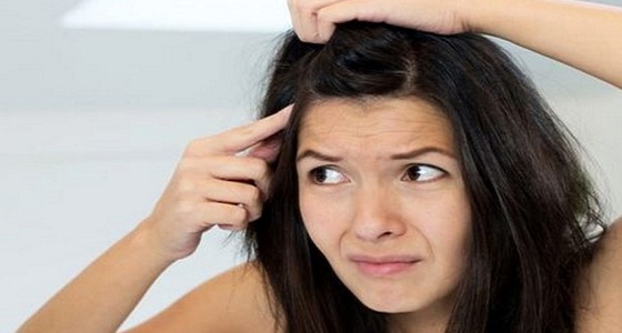 دراسة تكشف ارتباط قشرة الرأس بمرض خطير