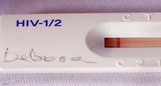 شفاء ثالث مريض في العالم من الإيدز 