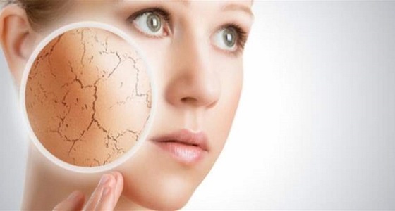 أسباب جفاف البشرة وطرق علاجها