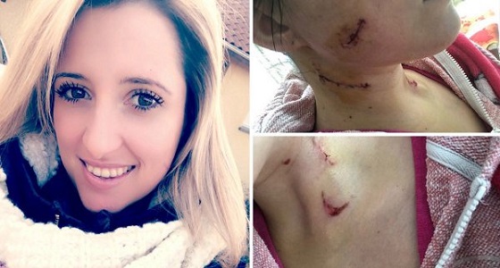 بالصور.. ” وشاح صوفي ” ينقذ امرأة من الموت