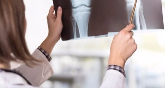 احمي عظامك مع تقدمك في السن بهذه النصائح