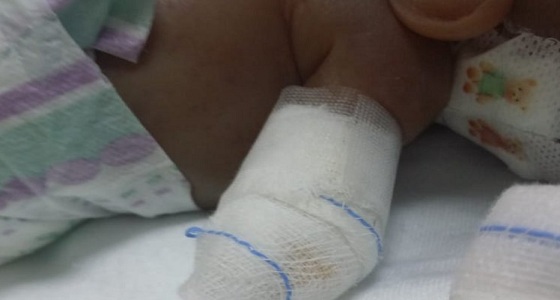وفاة الطفل حديث الولادة الذي سقطت يده في المستشفى بتبوك