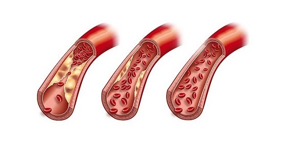 ” النمر ” : تدخين الشيشة يرفع الدهون الثلاثية نسبيا