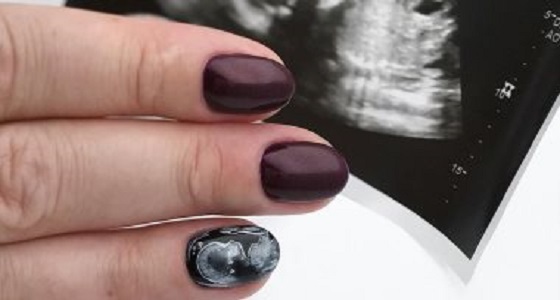 بالصور.. طلاء السونار أحدث صيحات تجميل الأظافر بين الأمهات