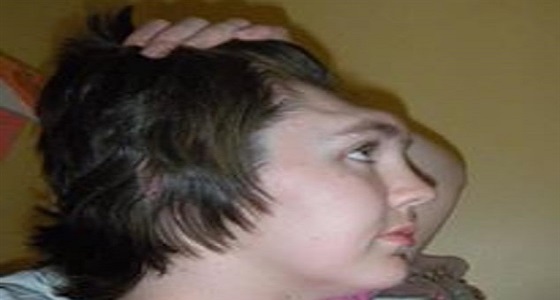 بعد فقدان جبهتها.. سيدة تحذر ركاب السيارات من خطورة أمر يفعله الكثيرون يوميا 