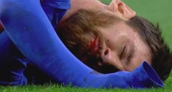 ميسي يخضع لفحوصات طبية بعد إصابته في مباراة مانشستر