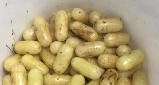 فريق طبي بمكة ينقذ حياة معتمر حاول تهريب 120 حبة بأحشائه