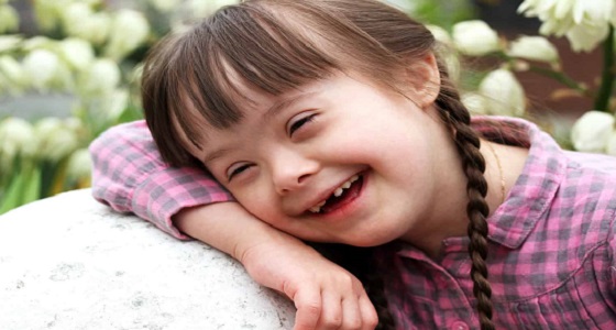 اكتشاف عقار يعالج حالات داون قبل الولادة