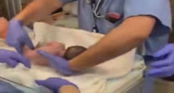 بالفيديو.. لحظة سقوط طفلة بشكل مفاجئ من يد الطبيب بعد ثوان من ولادتها