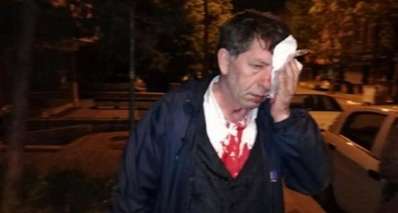 بعد حلقة تليفزيونية.. بلطجية أردوغان يلقنون صحفي معارض علقة ساخنة