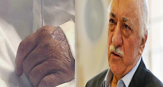 صحفي تركي يستخدم &#8221; يد مواطن سعودي &#8221; وينسبها للمعارض فتح الله كولن!