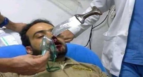 بالصور.. قيادي حوثي يطعن حارس مطعم بخنجر في وجهه