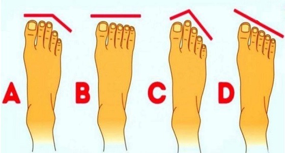 شكل قدمك يكشف شخصيتك