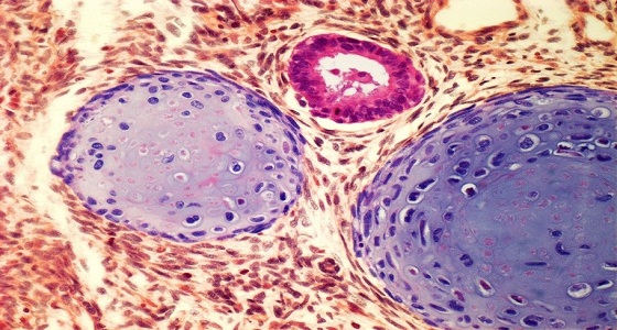 الأسماك تقلل خطر الإصابة بسرطان الخصية لدى الذكور