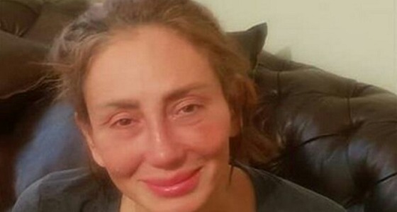 بعد إزالة أنفها.. يومان لتحديد مصير ريهام سعيد