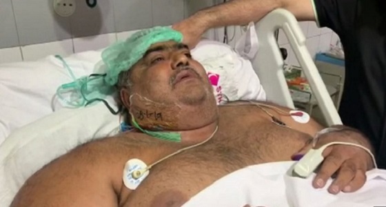 مشاجرة مع الأطباء تنهي حياة أسمن رجل في باكستان