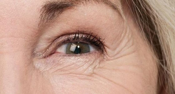 القهوة تُخفي علامات التعب حول العينين ومفيدة للبشرة