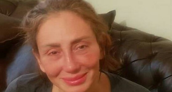 ريهام سعيد تتحدث عن مرضها: أزلت أنفي بالكامل وحياتي مهددة