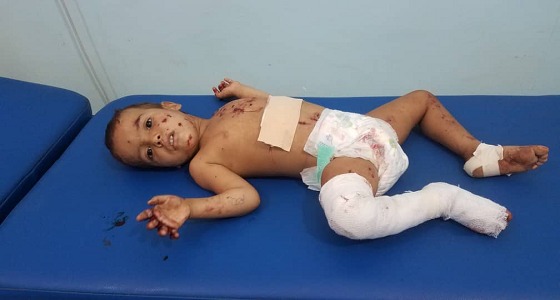 إصابة طفلين في قذيفة أطلقتها ميليشيا الحوثي بمحافظة الجوف اليمنية