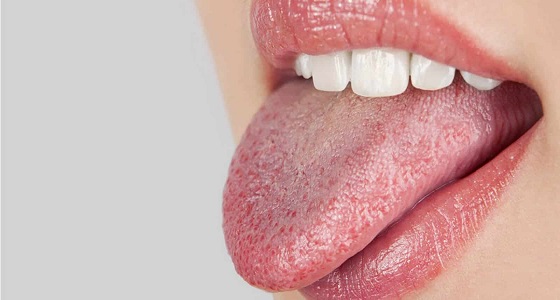 أسباب جفاف الفم عند الاستيقاظ وطرق علاجه