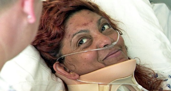 لمدة 6 أيام.. امرأة تعيش على قطرات الأمطار والندى بعد تعرضها لحادث