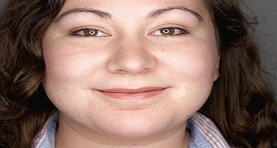 طريقة بسيطة للتخلص من سمنة الخدود بلا جراحة