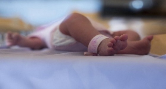 ولادة رضيع بأربع عيون وفمين